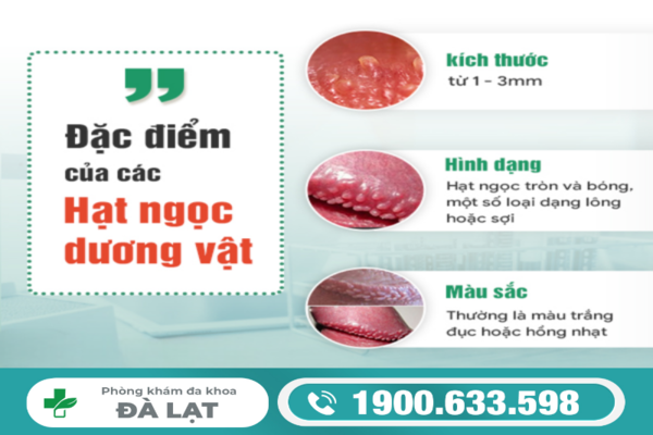 Hình ảnh minh họa